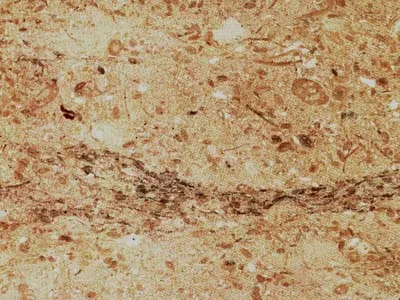 Chiampo Perlato – Limestone