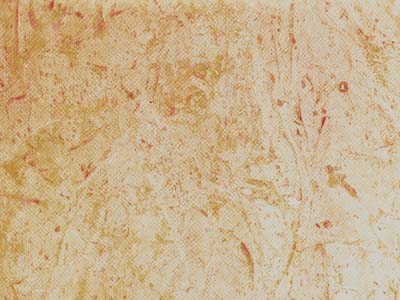 Algonquim Limestone – Limestone